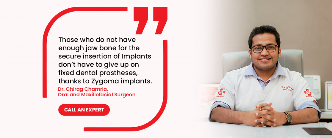 Dr Chirag Chamria Zygomatic Implant