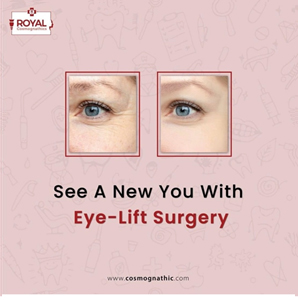Eyelid surgery