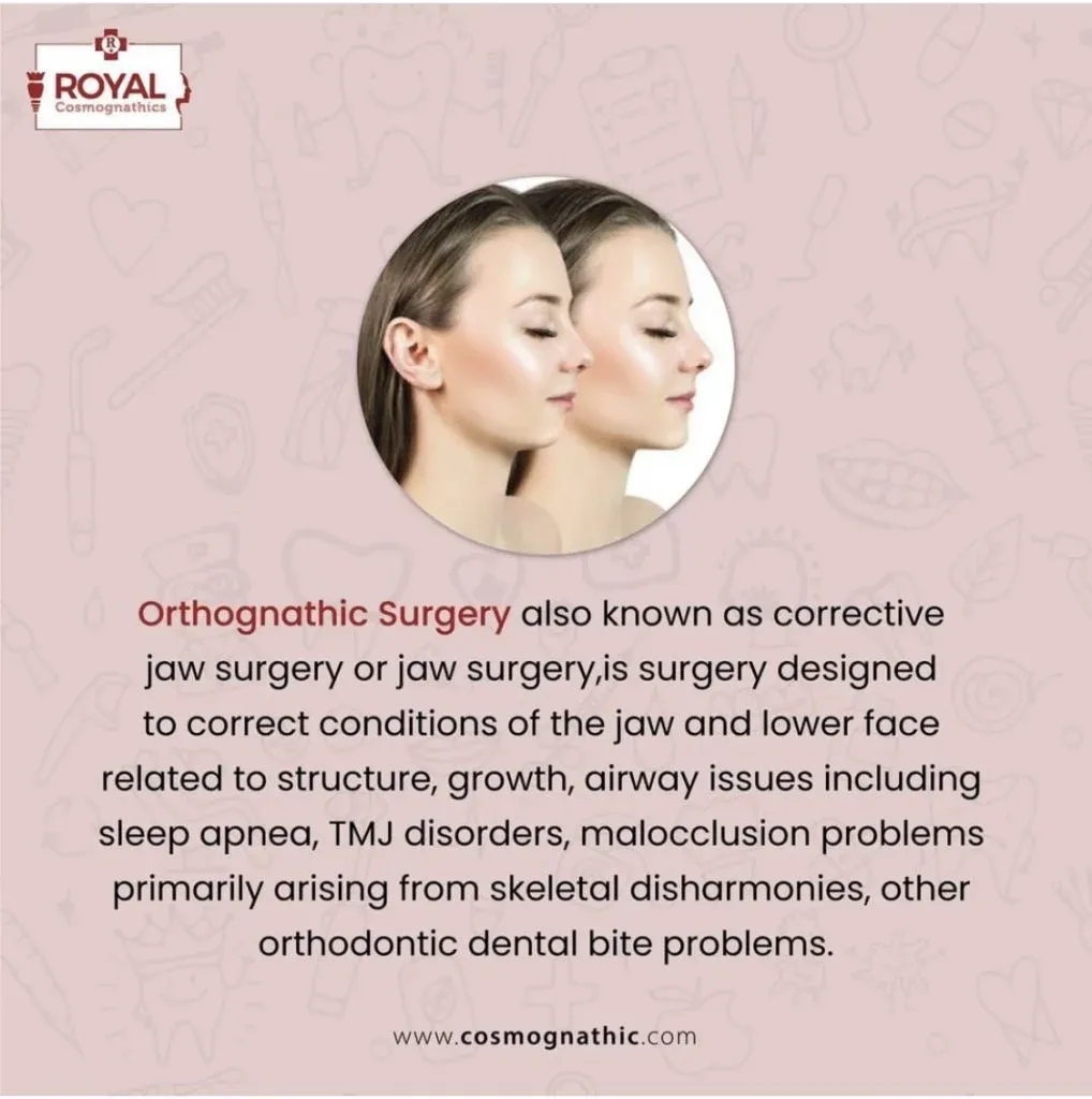 Best Jaw Alignment Surgery in Mumbai