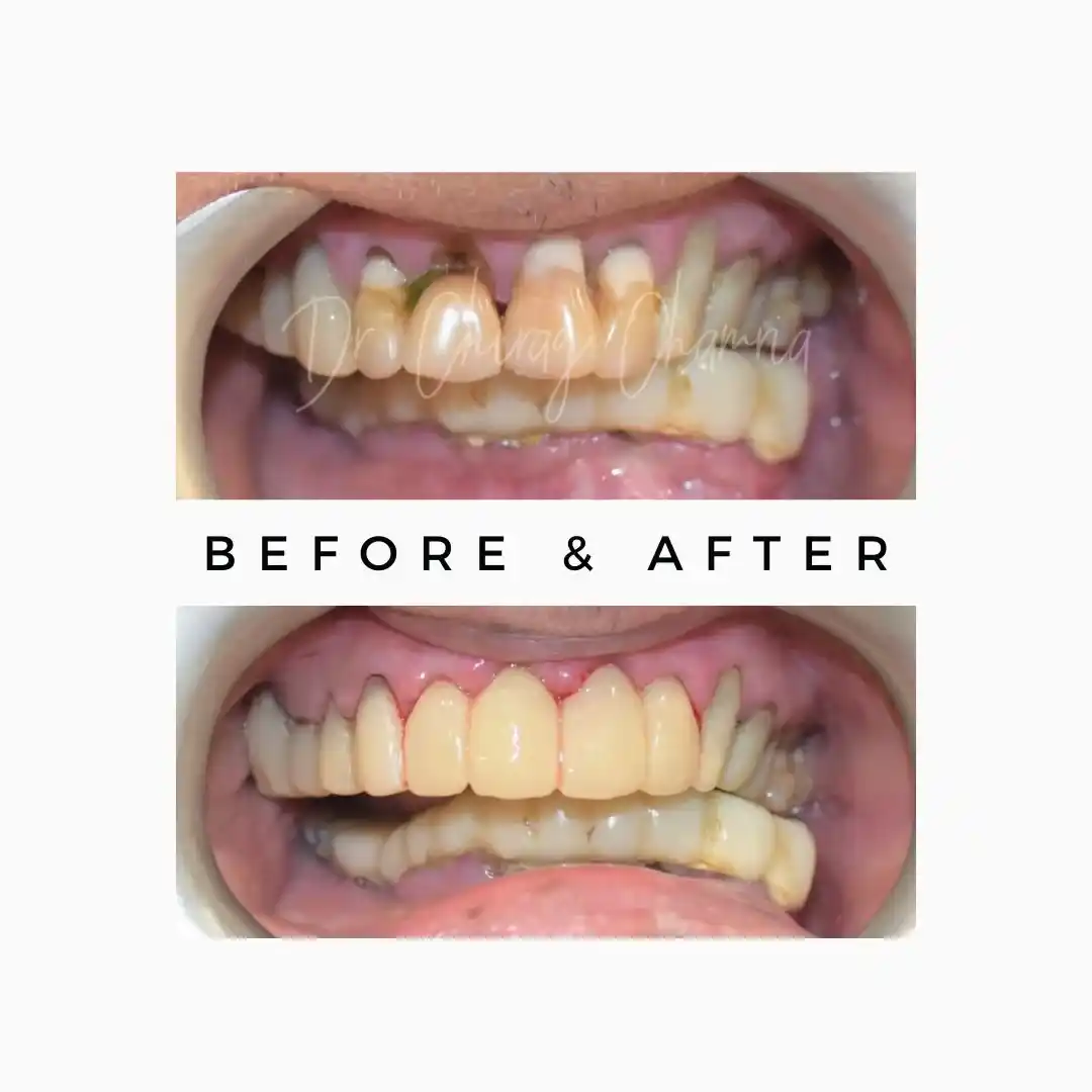 Royal Cosmognathic Dental Surgeon in Mumbai